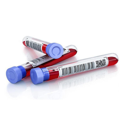 UV de Waarschuwingsetiketten van het Drukopp Medicijn voor de Buis van de Bloedinzameling